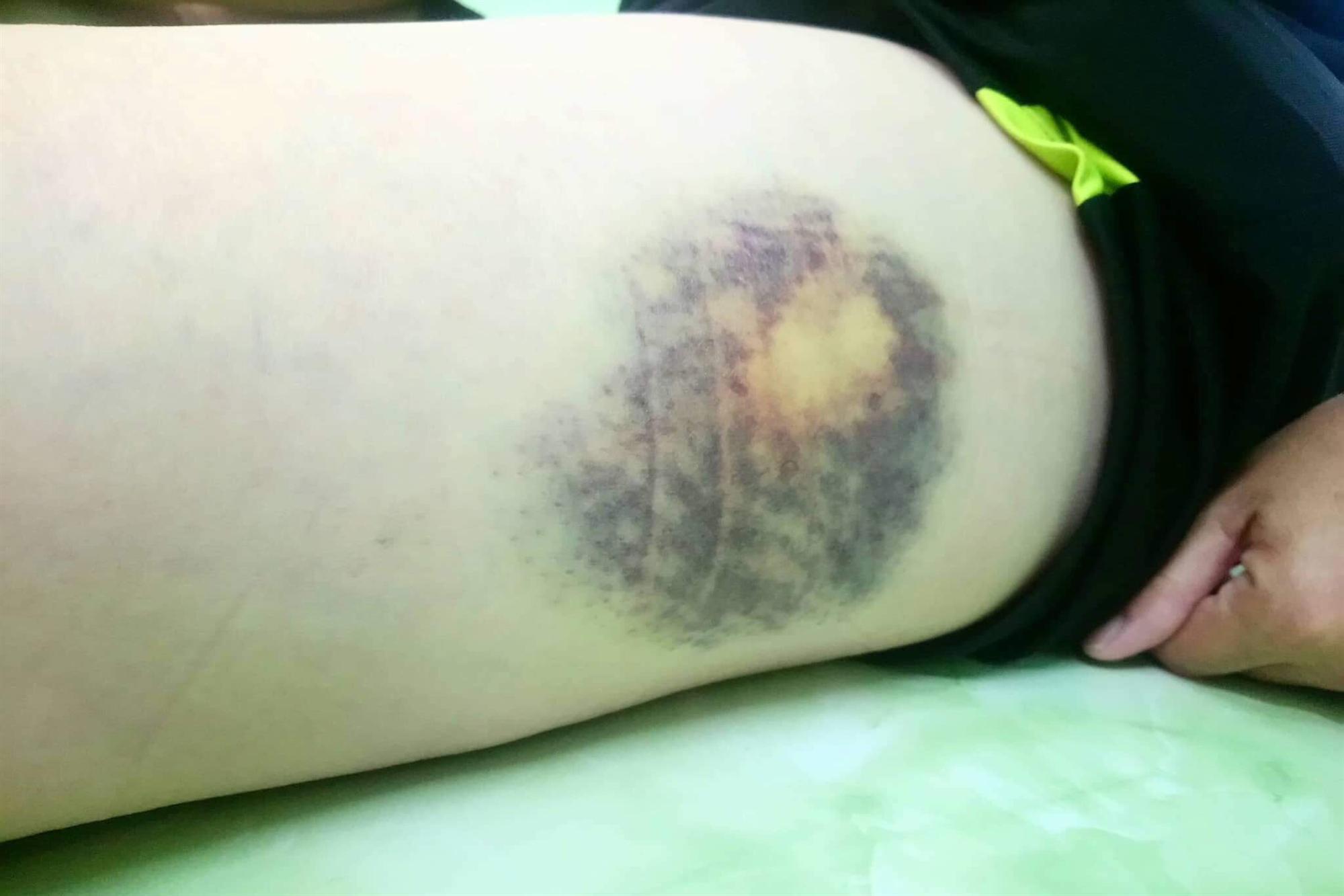 Nữ tài xế taxi tố bị bảo vệ bệnh viện dùng tuýp sắt đánh rách đầu-2