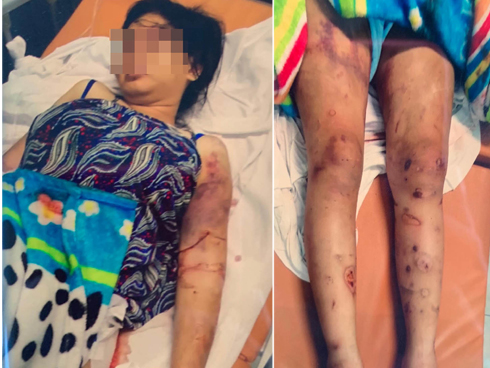 Nghi can khai sử dụng ma túy trước khi tra tấn cô gái trẻ ở TP.HCM đến sẩy thai-2