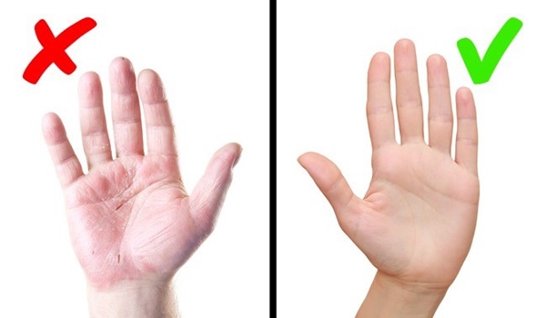 Nếu làn da của bạn xuất hiện 1 trong 8 dấu hiệu tưởng rất bình thường dưới đây, hãy coi chừng!-7