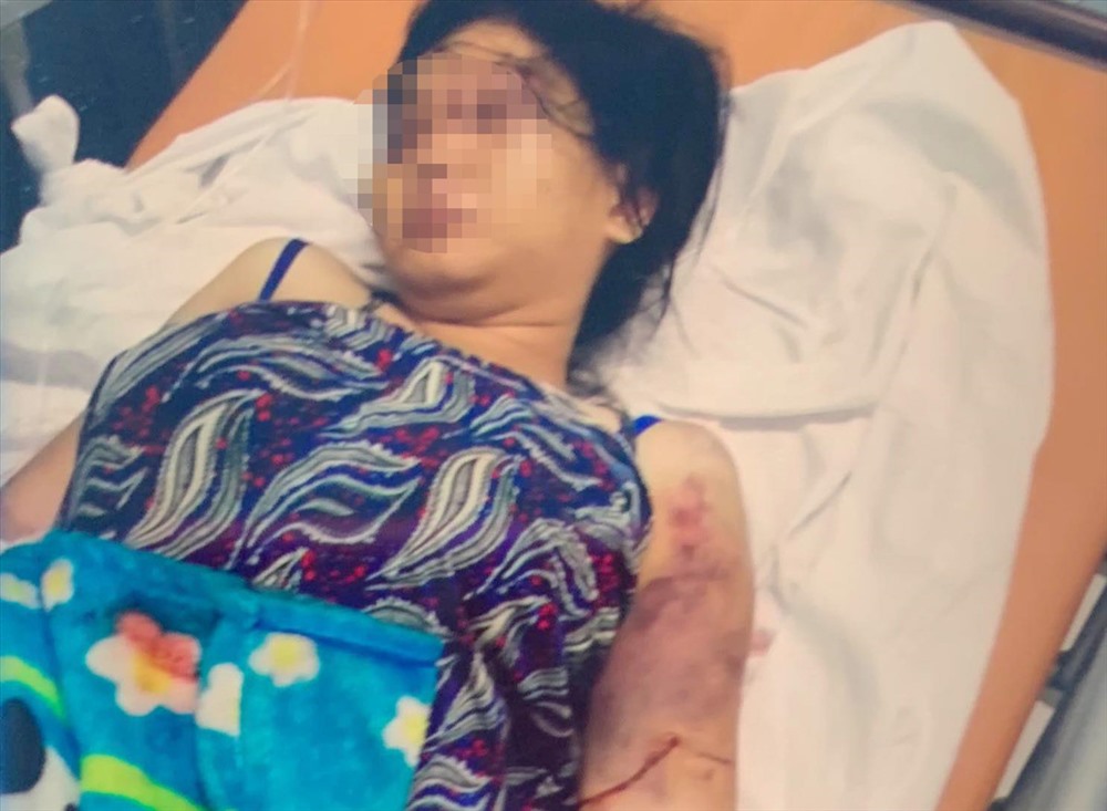 Nghi can khai sử dụng ma túy trước khi tra tấn cô gái trẻ ở TP.HCM đến sẩy thai-1