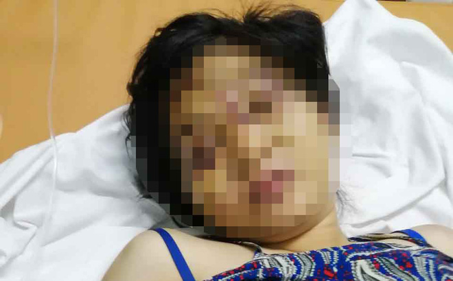 Lời kể rợn người của bà bầu bị nhóm giang hồ phê ma túy tra tấn khiến sinh non, thai nhi tử vong-1