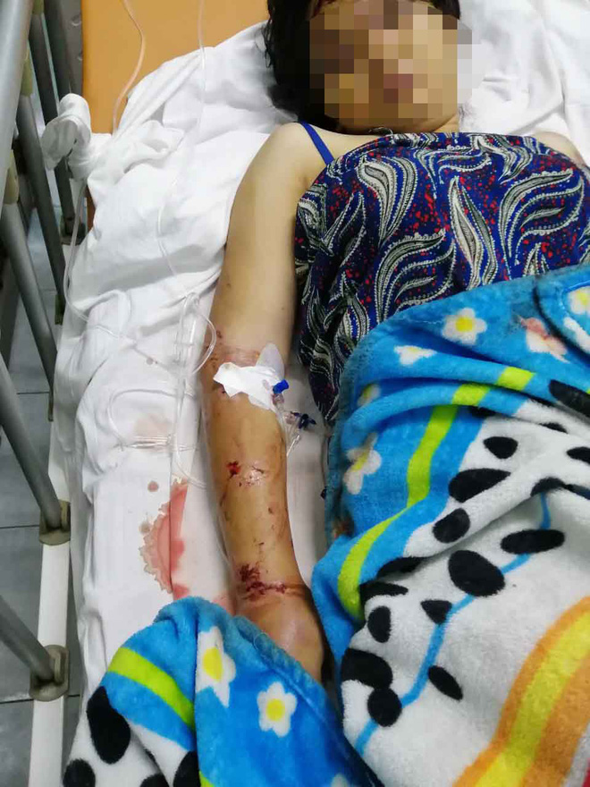 Lời kể rợn người của bà bầu bị nhóm giang hồ phê ma túy tra tấn khiến sinh non, thai nhi tử vong-2