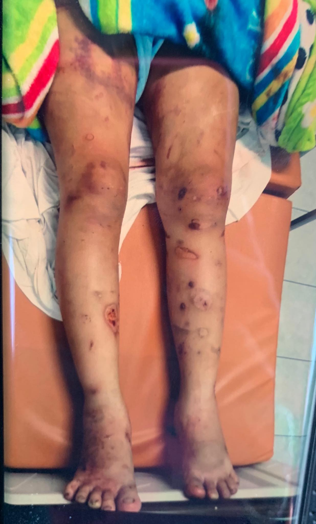 Hé lộ món nợ của anh trai khiến cô gái mang thai 6 tháng bị tra tấn dã man, thai nhi tử vong-3