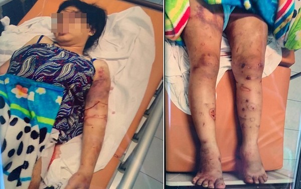 Vụ cô gái mang bầu 6 tháng bị tra tấn đến sảy thai: Người nhặt ve chai hoảng sợ khi thấy thi thể bé sơ sinh trong túi nylon-1