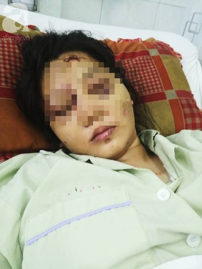 Cô gái mang bầu 6 tháng bị bắt cóc, tra tấn đến sảy thai bị sang chấn tâm lý, la hét, kích động trong bệnh viện-1