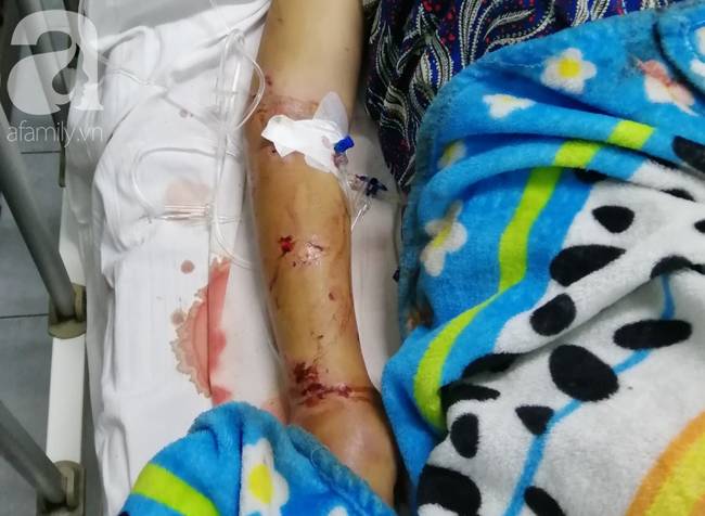 Cô gái mang bầu 6 tháng bị bắt cóc, tra tấn đến sảy thai bị sang chấn tâm lý, la hét, kích động trong bệnh viện-3