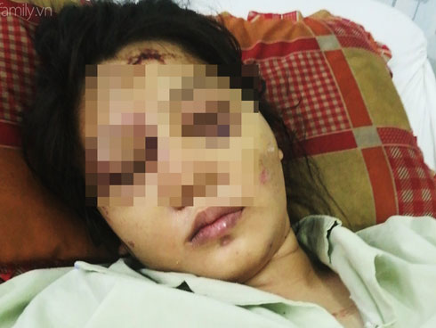 Thai phụ bị giam giữ, tra tấn đến sảy thai ở Sài Gòn: Chỉ vì hơn 1 triệu đồng sao mà tàn ác với nhau thế-4