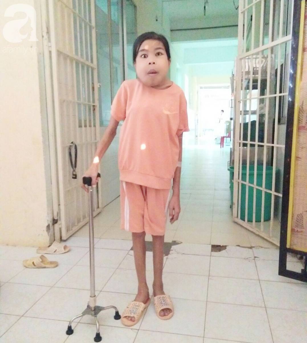 Bị suy thận nhưng vẫn cố giữ thai nhi, người mẹ bị biến dạng khuôn mặt, chấp nhận chết để con gái nhỏ được chào đời-10