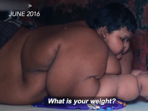 Bé trai nặng 190kg đổi đời khi giảm 104kg nhưng thân hình hiện tại vẫn gây sốc