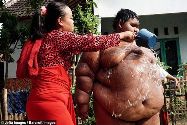 Bé trai nặng 190kg đổi đời khi giảm 104kg nhưng thân hình hiện tại vẫn gây sốc-5