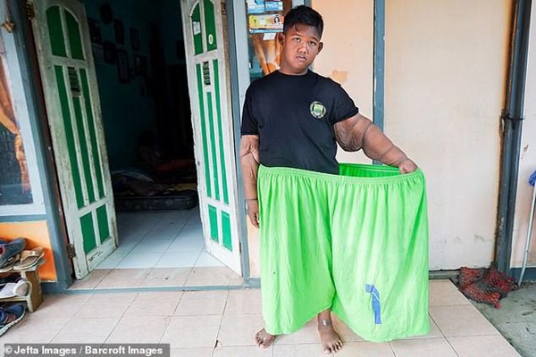 Bé trai nặng 190kg đổi đời khi giảm 104kg nhưng thân hình hiện tại vẫn gây sốc-11