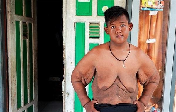 Bé trai nặng 190kg đổi đời khi giảm 104kg nhưng thân hình hiện tại vẫn gây sốc-9