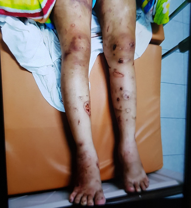 Thai phụ bị giam giữ, tra tấn đến sảy thai ở Sài Gòn: Chỉ vì hơn 1 triệu đồng sao mà tàn ác với nhau thế-2