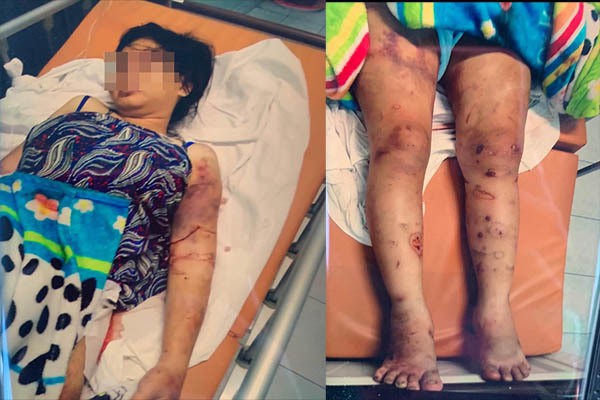 Vụ tra tấn như thời trung cổ khiến bà bầu sảy thai: Nạn nhân bị bắt hít ma tuý, dùng ná bắn vào vùng kín-1