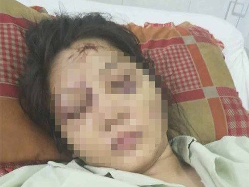 Vụ tra tấn như thời trung cổ khiến bà bầu sảy thai: Nạn nhân bị bắt hít ma tuý, dùng ná bắn vào vùng kín