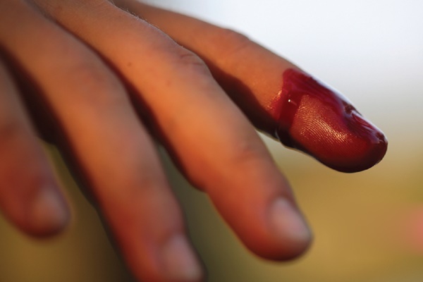 30.000 người Việt mang gen bệnh di truyền không có thuốc chữa, ít người biết-2