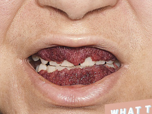 Bé gái Việt mang căn bệnh hiếm, cả thế giới chỉ có 38 trẻ mắc-2