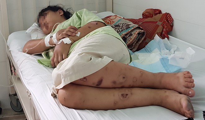 Em gái bị bắt giữ hành hạ đến sảy thai, vì sao anh trai biết mà không cứu?-2