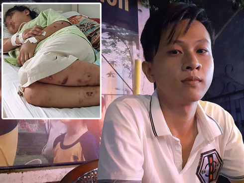 Dàn dựng tai nạn giao thông để chụp ảnh câu like, nam thanh niên bị công an triệu tập-2