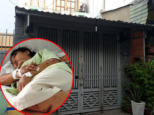 Bắt khẩn cấp kẻ chủ mưu giam thai phụ 18 tuổi, tra tấn làm chết thai nhi-3