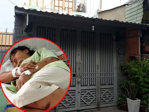 Hành tung bí ẩn của kẻ thủ ác trong