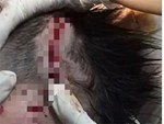 Thái Nguyên: Bé trai 7 tuổi bị con chó mới nuôi của gia đình cắn tử vong-2