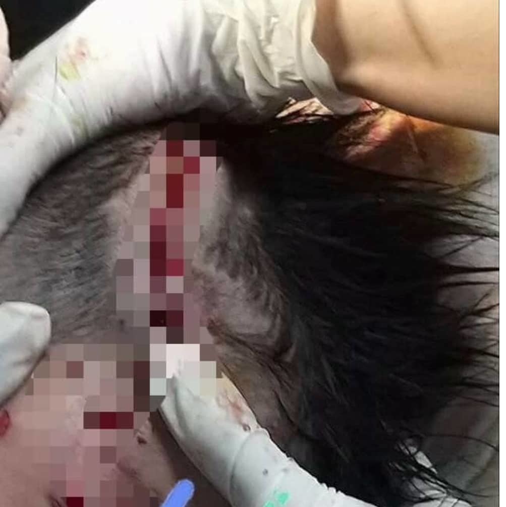 Bé trai 4 tuổi ở Hà Tĩnh bị chó béc giê nhà lao vào cắn xé-1