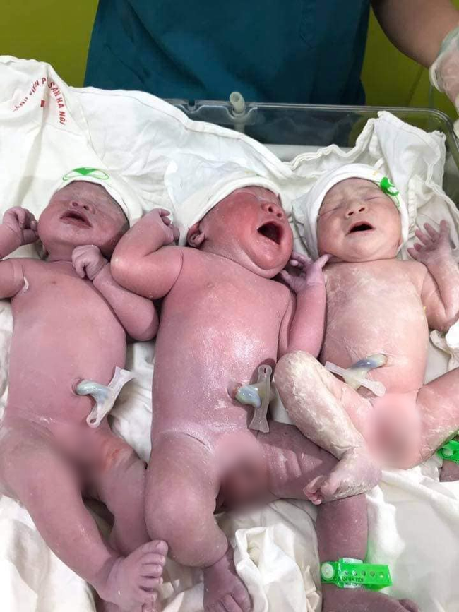 Hội bỉm sữa xôn xao trước ca sinh 3 siêu tiết kiệm, đẻ một lần có đủ cả nếp lẫn tẻ-1