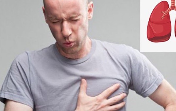 Cách đơn giản phòng căn bệnh sát thủ khiến nhiều người Việt chết nhất-1