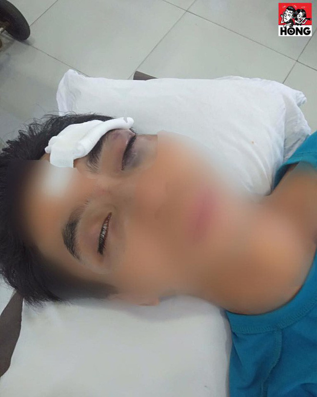 Trời nóng càm ràm nhiều, chồng bị vợ ném điện thoại vào mặt, chấn thương phải đi cấp cứu gấp-1