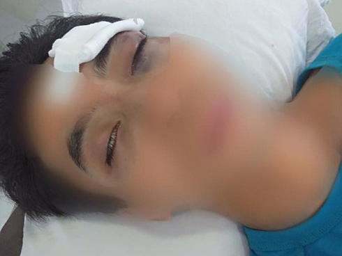 Trời nóng càm ràm nhiều, chồng bị vợ ném điện thoại vào mặt, chấn thương phải đi cấp cứu gấp