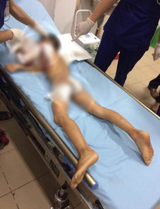 Thái Nguyên: Bé trai 7 tuổi bị con chó mới nuôi của gia đình cắn tử vong-1