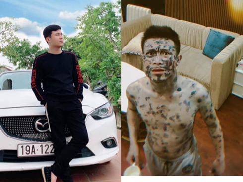 Chồng bị bệnh nằm nhà, vợ hot mom ủ mưu chụp ảnh