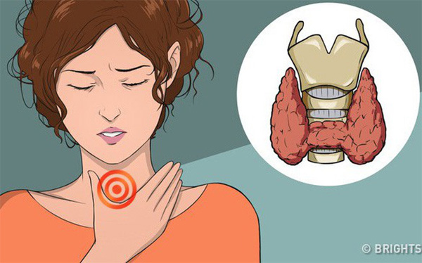 11 dấu hiệu cảnh báo bệnh tuyến giáp: Nếu không chú ý can thiệp sớm sẽ rất nguy hiểm-1