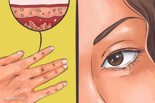 11 dấu hiệu cảnh báo bệnh tuyến giáp: Nếu không chú ý can thiệp sớm sẽ rất nguy hiểm-4