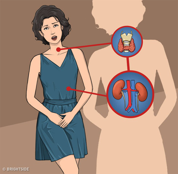 11 dấu hiệu cảnh báo bệnh tuyến giáp: Nếu không chú ý can thiệp sớm sẽ rất nguy hiểm-9