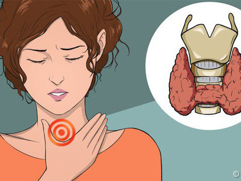 Nỗi lo của nhiều mẹ Việt: Mắc bệnh tuyến giáp có được sinh con và cho con bú?-3