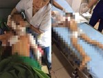 Kinh hoàng clip cụ bà ở Hà Nội bị chó cắn máu me đầm đìa, người phụ nữ cố giải cứu trong bất lực-3