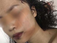 Bắc Ninh: Cô gái 18 tuổi bị bạn cũ lao vào phòng rạch mặt, cổ và tay, phải khâu 60 mũi