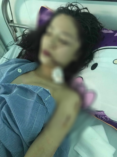 Chị ruột cô gái bị tấn công phải khâu 60 mũi: Mặt em tôi bị rạch như thế thì coi như hết đời người rồi-2