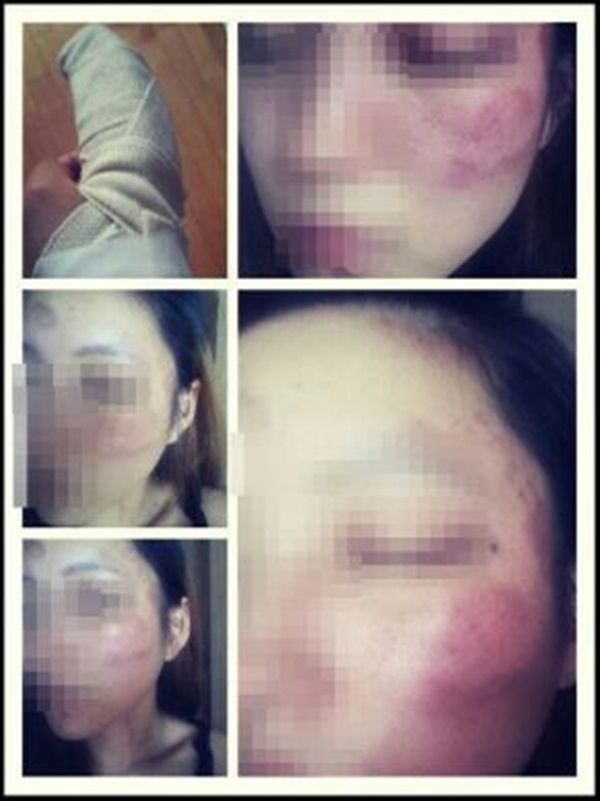 Cương quyết đòi chia tay bạn trai bạo lực, cô giáo xinh đẹp nhận cái kết bi thảm khiến dư luận sục sôi-7