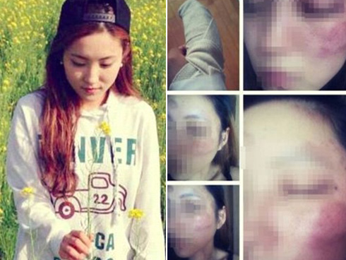 Chàng trai khỏa thân xông vào đồn cảnh sát, đòi kiện bạn gái làm gãy của quý-2