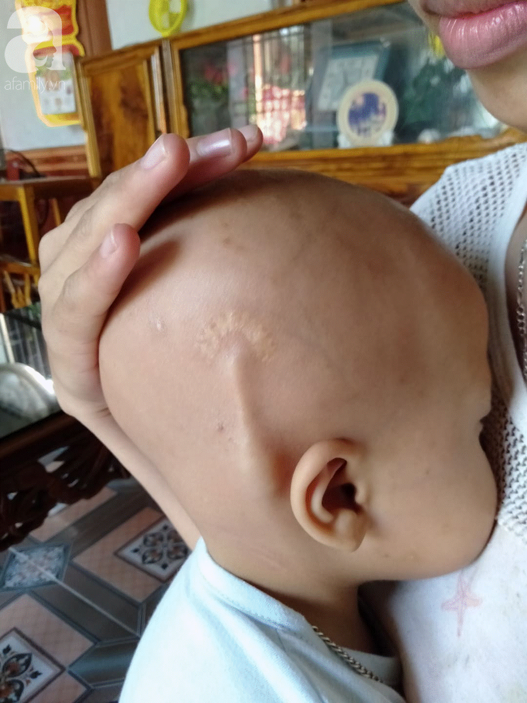 Điều ước trong nước mắt của bé trai mắc bệnh hiểm nghèo, gần 3 tuổi vẫn chưa biết đi: Cháu muốn về với mẹ, với em”-5