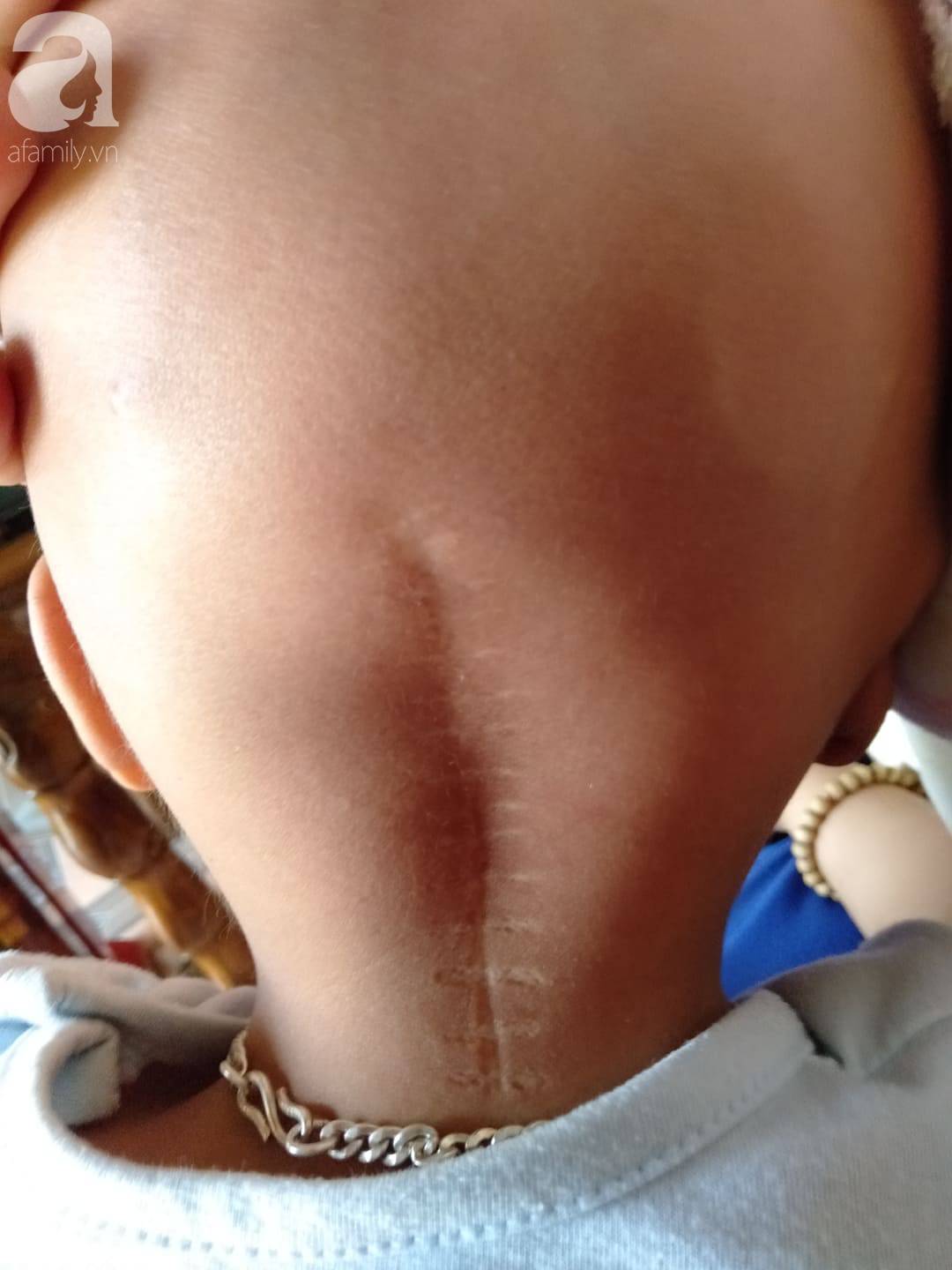 Điều ước trong nước mắt của bé trai mắc bệnh hiểm nghèo, gần 3 tuổi vẫn chưa biết đi: Cháu muốn về với mẹ, với em”-4