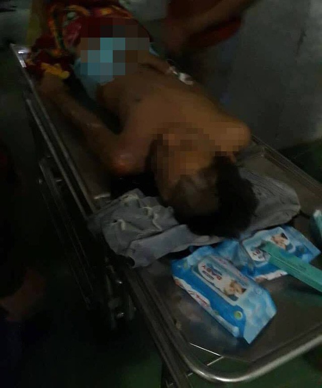 Bị sét đánh, nam thanh niên thoát chết hy hữu-1