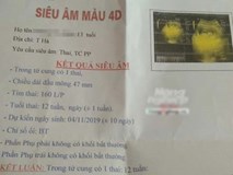 Chủ tịch tỉnh Lào Cai chỉ đạo họp khẩn vụ "Thầy giáo làm học sinh lớp 8 mang thai" Chủ tịch tỉnh Lào Cai chỉ đạo họp khẩn vụ "Thầy giáo làm học sinh lớp 8 mang thai"