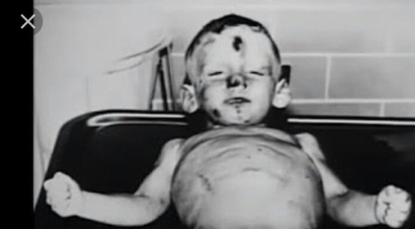 Cuộc sống như địa ngục trước khi lìa đời của cậu bé 3 tuổi, liên tục bị mẹ nuôi ruồng bỏ, hành hạ và xâm hại vùng kín-5