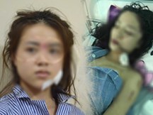 Cô gái rạch mặt khiến bạn cũ phải khâu 60 mũi trần tình: “Q. đánh tôi trước, sao mọi người chỉ bênh cô ấy mà mạt sát tôi?