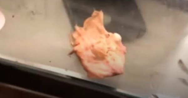 Cô gái khẳng định vừa hắt xì ra miếng bông băng bác sĩ bỏ quên khi sửa mũi, kiện phòng khám 346 triệu đồng-2