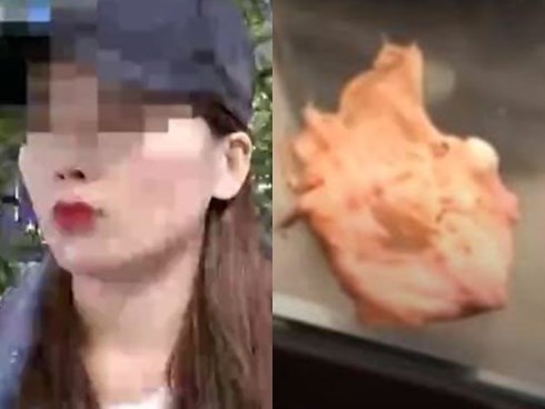 Cô gái khẳng định vừa hắt xì ra miếng bông băng bác sĩ bỏ quên khi sửa mũi, kiện phòng khám 346 triệu đồng